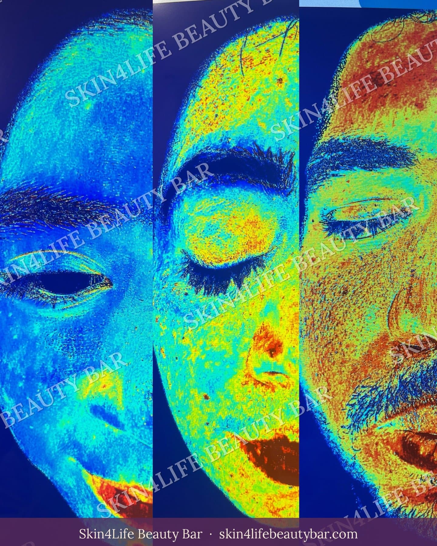AI skin scan of half faces showing redness differences.